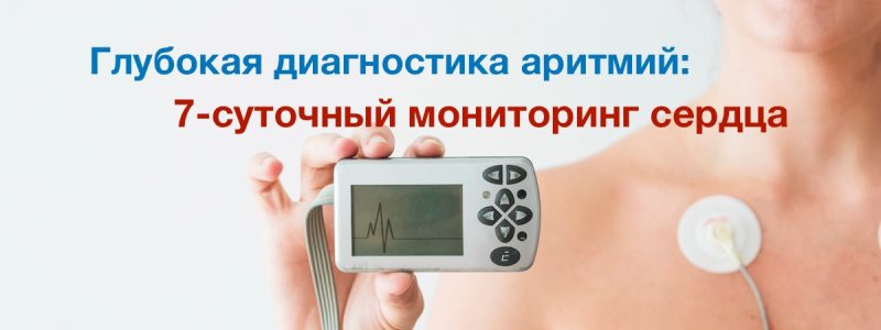 Глубокая диагностика аритмий в «Семейной кардиологии»: 7-суточный мониторинг сердца Глубокая диагностика аритмий в «Семейной кардиологии»: 7-суточный мониторинг сердца