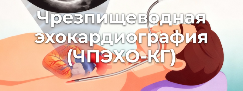 Чрезпищеводная эхокардиография в Барнауле — ЧПЭХО-КГ Чрезпищеводная эхокардиография в Барнауле — ЧПЭХО-КГ